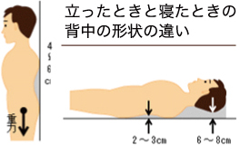 背骨の形状の違い